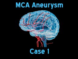 MCA aneurysms case 1