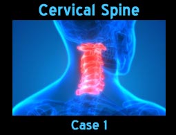 cervical spine case1