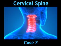 cervical spine case2