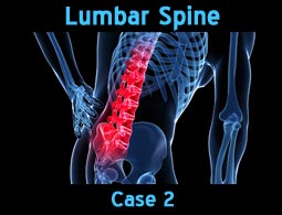 lumbar spine case2