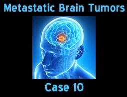 Metastatic case 10