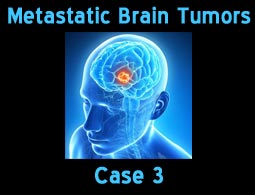 Metastatic case 3
