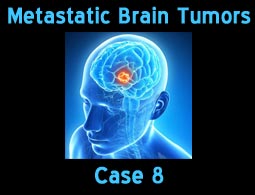 Metastatic case 8