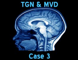 tgn mvd case3
