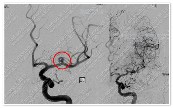 Case 1 Image 3