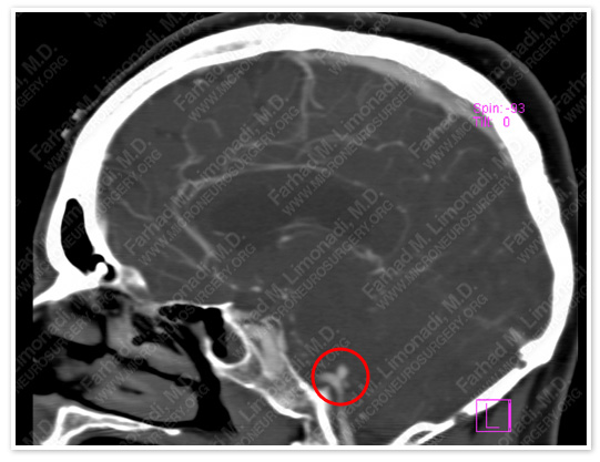 Case 2 Image 3