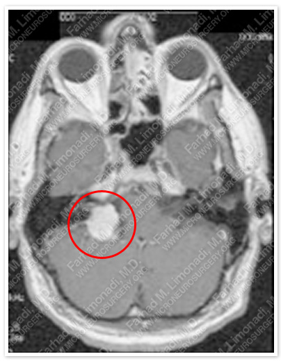 Case 1 Image 1