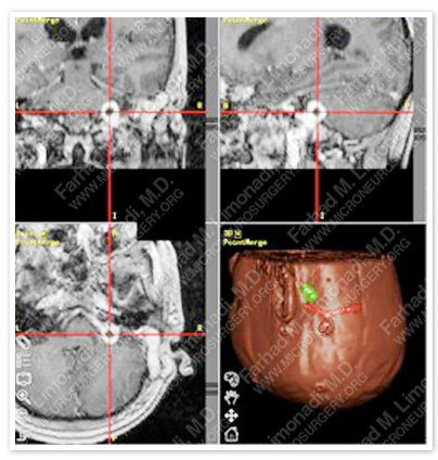 Case 1 Image 2