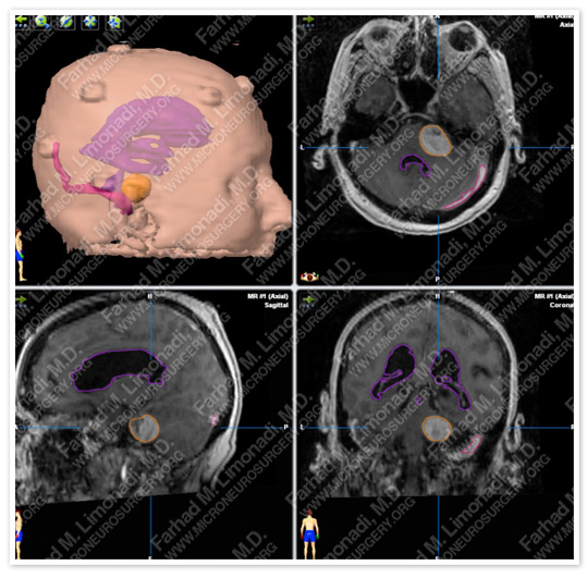 Case 3 Image 4