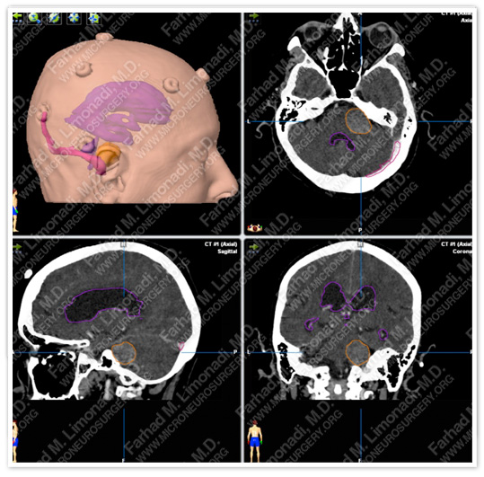 Case 3 Image 5