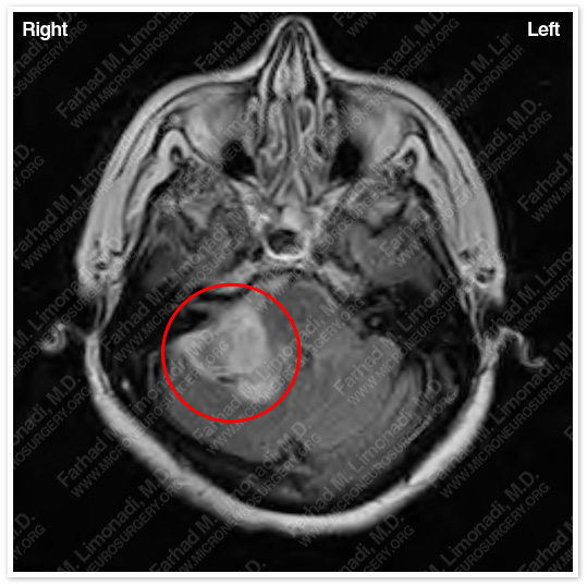 Case 4 Image 2