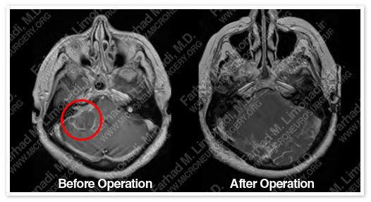 Case 4 Image 8