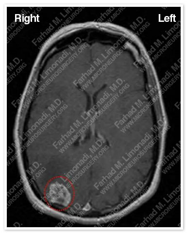 Case 1 Image 1