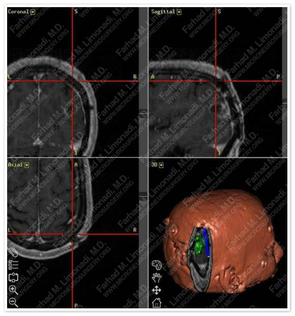 Case 1 Image 2