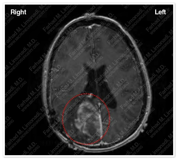 Case 1 Image 1