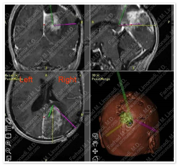 Case 1 Image 2