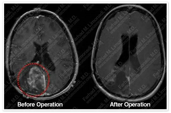 Case 1 Image 4