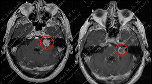 Case 6 Image 1