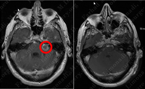 Case 6 Image 5