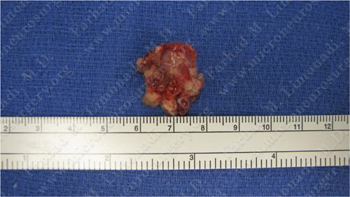 Case 5 Image 3