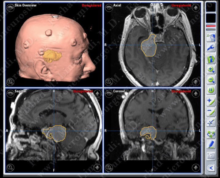 Case 17 Image 2