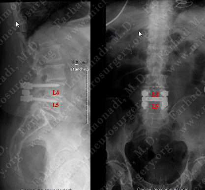 Case 1 Image 2